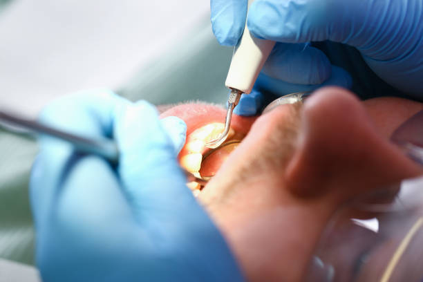 Best Emergency Treatment for Oral Infections in Sand Point, AK