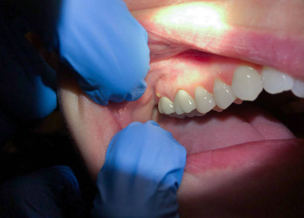 Best Emergency Care for Gum Disease in Sand Point, AK