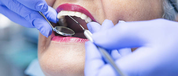 Best Emergency Wisdom Tooth Extraction in Sand Point, AK
